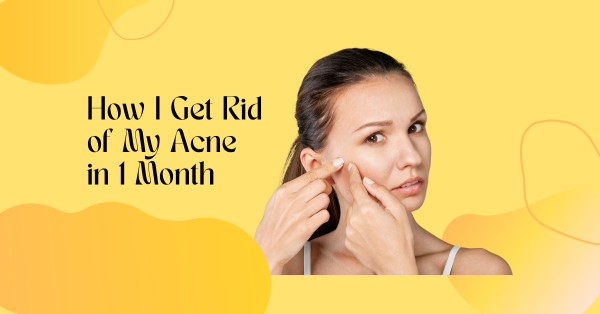 The Best Acne-Fighting Skincare Routine